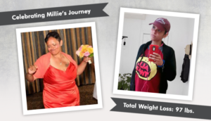 Before-After-VSG-with-Millie-760x435